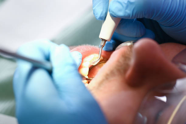 Best After-Hours Emergency Dentist in Dent, OH