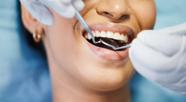 Best Emergency Tooth Extraction in Dent, OH